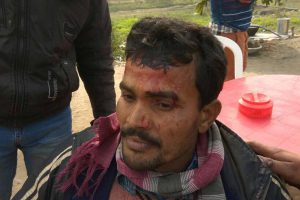 Injured BJP activist Bipad Biswas