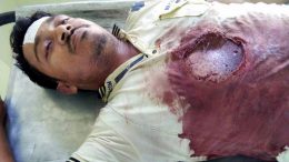 Bullet ridden body Rafiqul Sheikh at JNM Hospital in Kalyani