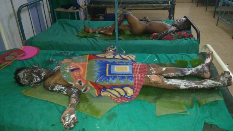 The injured victims at Saktinagar district hospital in Krishnanagar.