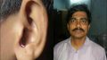 Accused head master Bhaskar Biswas (left) and the injured left ear of the student