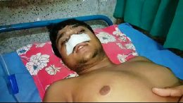 One of the victims at Ranaghat Sub Divisional Hospital